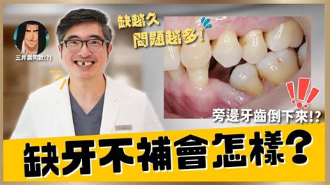 缺牙會漏財嗎|缺牙一定要補牙嗎？不處理會怎樣？醫提醒「這些病」。